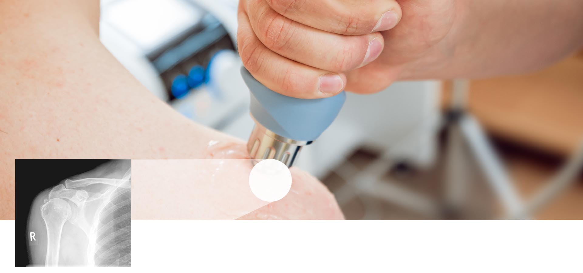 praxis_fuer_orthopaedie_mainz_stosswellentherapie_schulter | Praxis für ...